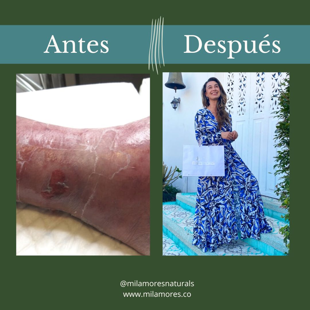 Milamores cambio mi vida