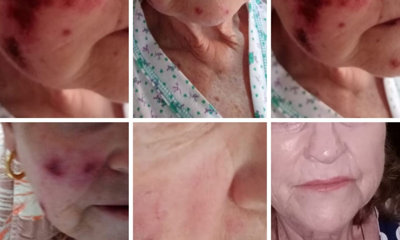 De la desesperanza a la esperanza: Cómo MagicOil y HappyDay transformaron una vida