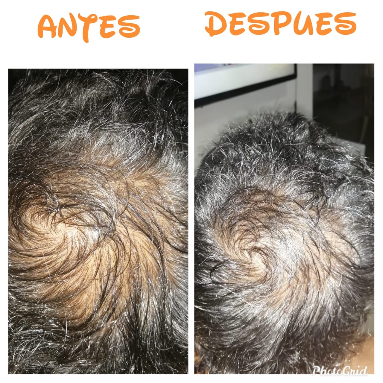 The Hair & Skin Repair & Nourish Kit